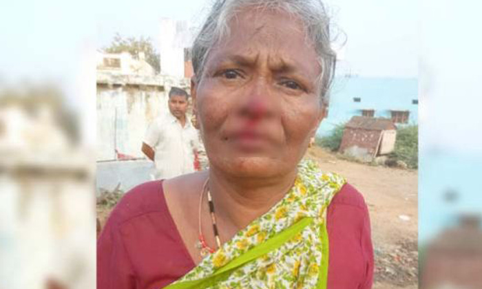  Woman Bites Her Mother In Law Nose In Alampur, Daughter In Law, Gadwal, Revathi,-TeluguStop.com