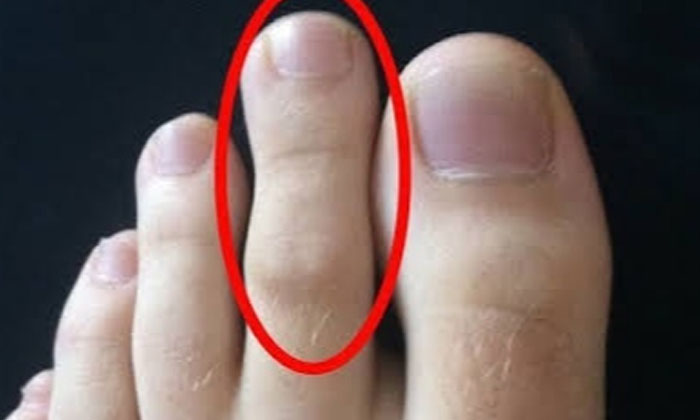  Do You Know What Happens If The Next Toe Is Longer Than The Big Toe, Health Tips-TeluguStop.com