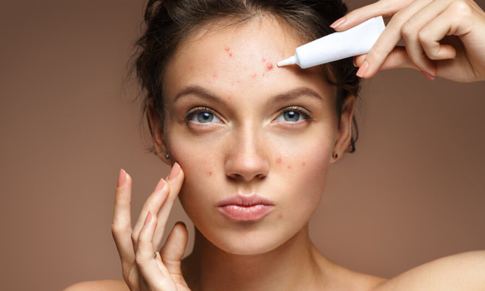  These Foods Help To Protect From Pimples! Good Food, Pimples, Latest News, Healt-TeluguStop.com