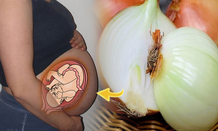  Do You Know What Happens If You Eat Raw Onion During Pregnancy?eat Raw Onion, P-TeluguStop.com
