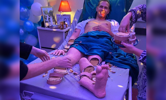  British Baker Ben Cullen Bakes Human Like Cake Viral Photo, Patient, Hand, Legs,-TeluguStop.com
