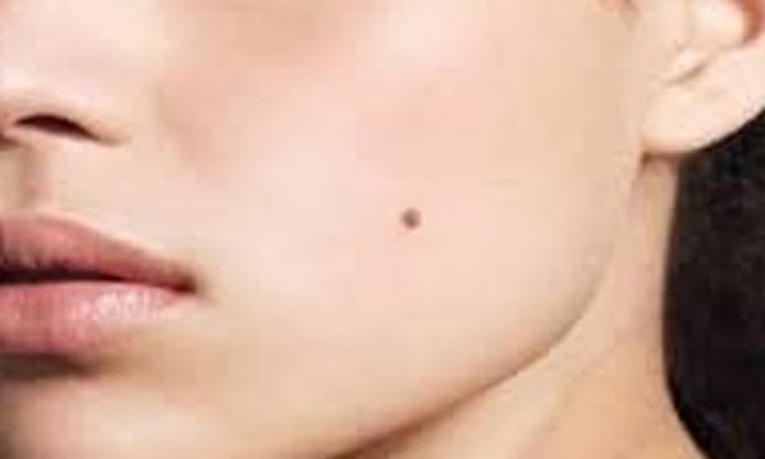  Do You Know The Benefits Of Having Birthmarks On Any Side, Mole, On Face, Right-TeluguStop.com