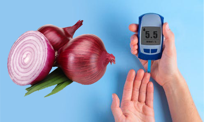  Red Onion To Control Blood Sugar Levels Quickly! Red Onion, Blood Sugar Levels,-TeluguStop.com