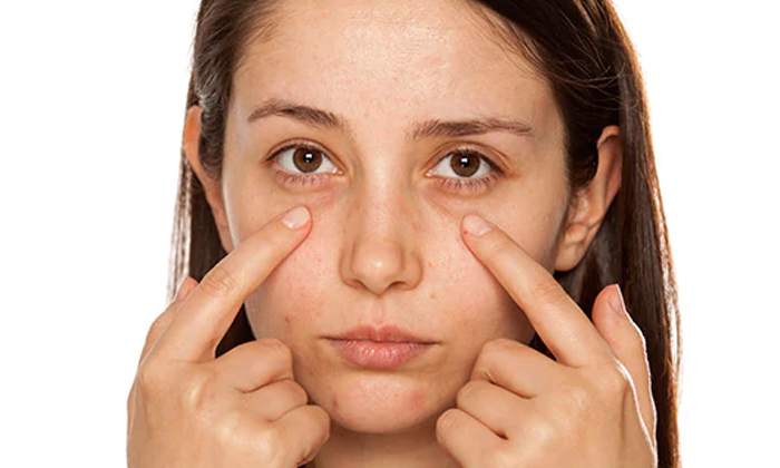  Home Remedies To Prevent Wrinkles Under Eyes! Home Remedies, Wrinkles Under Eyes-TeluguStop.com