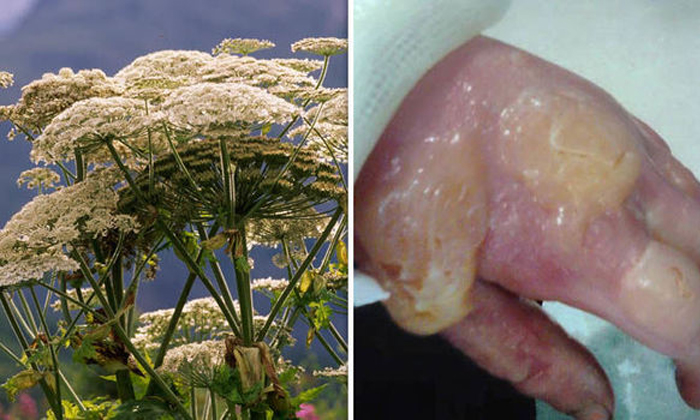  You Will Die If You Touch Poisonous Hogweed Plant , Plant, Touch, Died, Be Caref-TeluguStop.com