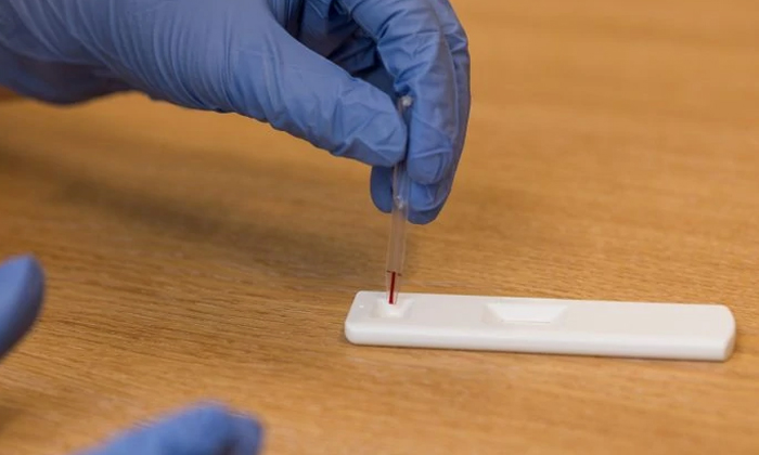  Rapid Blood Test For Anti Bodies Covid 19, Anti Bodies, Blood Test , Corona, A-TeluguStop.com