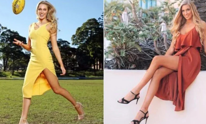  Australian Beauty Queen Insured  Her Legs For 1 Million Dollars, 1 Million Dolla-TeluguStop.com