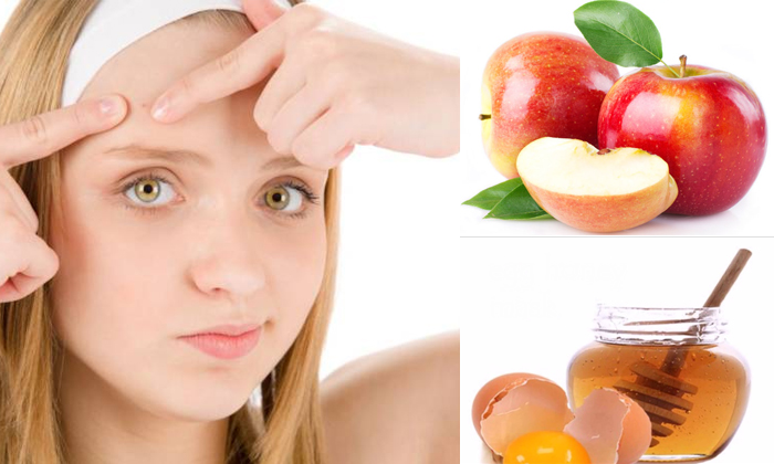 Telugu Apple, Tips, Egg White Oats, Face, Forehead, Latest, Pimples, Skin Care,