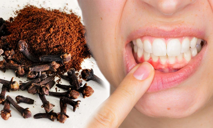  Home Remedies For Get Rid Of Swollen Gums! Home Remedies, Swollen Gums, Latest N-TeluguStop.com