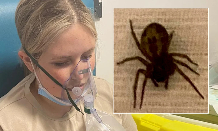  Australian Woman Undergoes Surgery After Venomous Spider Bites Her In Sleep,woma-TeluguStop.com