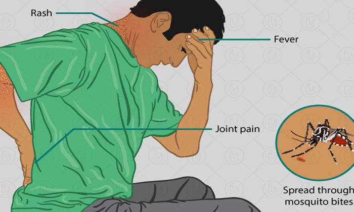 Telugu Headache, Tips, Latest, Muscle Pain, Rashes, Symptoms, Symptoms Zika, Zik