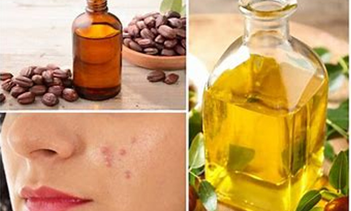  Jojoba Oil, Pimples, Benefits Of Jojoba Oil, Latest News, Skin Care, Skin Care-TeluguStop.com