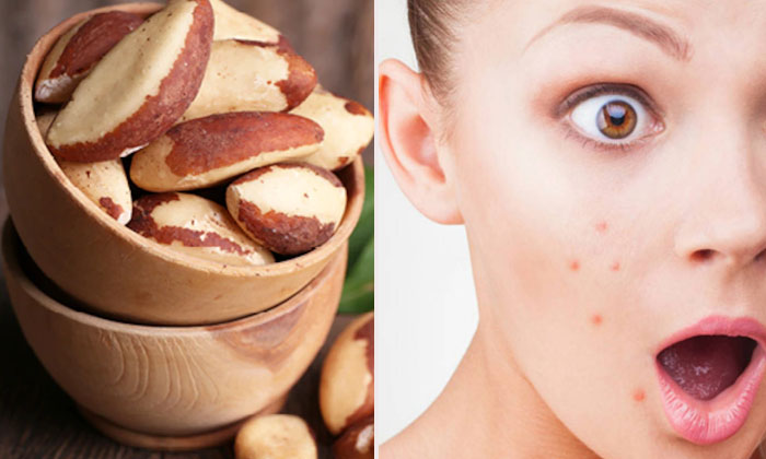  Wonderful Health Benefits Of Brazil Nuts! Health, Benefits Of Brazil Nuts, Brazi-TeluguStop.com