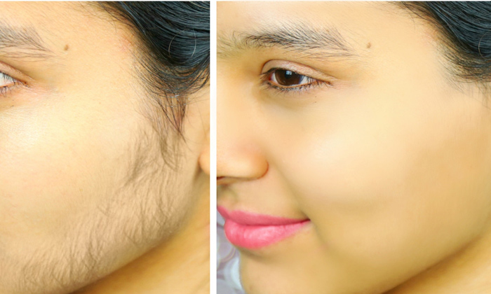 5 sure shot remedies to get rid of facial hair  The Times of India