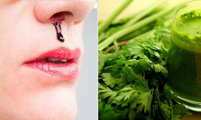  Home Remedies To Get Rid Of Nose Bleeding! Home Remedies, Nose Bleeding, Latest-TeluguStop.com