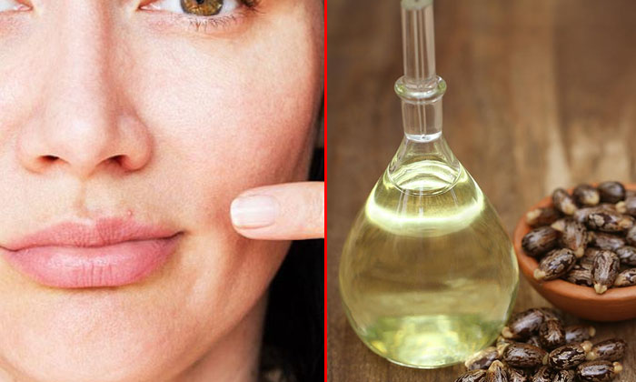  Home Remedies To Reduce Pimples On Lips! Home Remedies, Pimples On Lips, Lips, L-TeluguStop.com