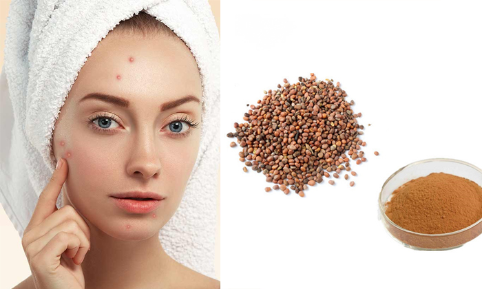 Telugu Tips, Benefitsradish, Pimple, Pimples, Radish Seeds, Reduce Pimple, Skin