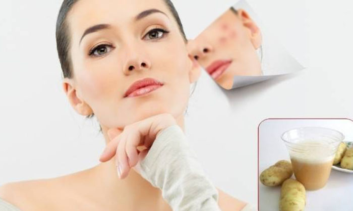  How To Get Rid Of White Spots On Face! White Spots On Face, White Spots, Latest-TeluguStop.com