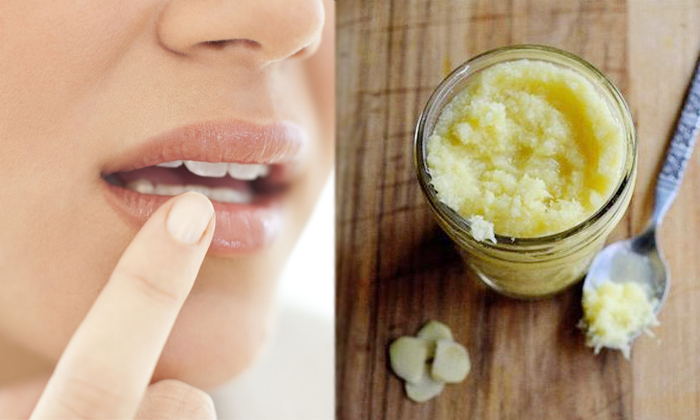  Home Remedies To Remove White Spots On Lips Details, Home Remedies, White Spots-TeluguStop.com