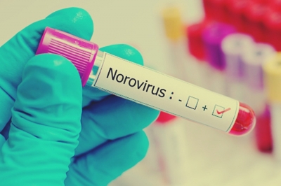  K’taka On High Alert For Norovirus Outbreak In Kerala-TeluguStop.com