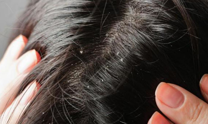  Side Effects Of Using Hair Gels Daily! Side Effects Of Hair Gels, Hair Gels, Usi-TeluguStop.com