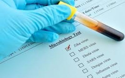  India Reported 1.77 Lakh Dengue, 237 Zika Virus Cases In 2021-TeluguStop.com