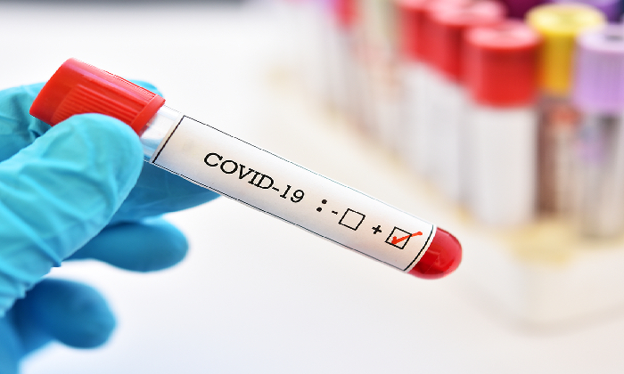  Covid 19: Covid Intensity Declining In India. 2,51,209 New Cases Reported!-TeluguStop.com