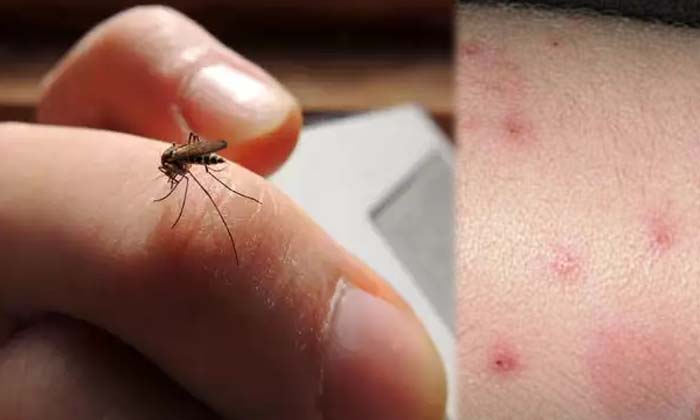  What If 10 Lakh Mosquitoes Bite You At Once Health Blood Doctor Died , Bite , Mo-TeluguStop.com