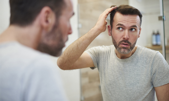 Reason Behind Men Getting Bald Head-TeluguStop.com