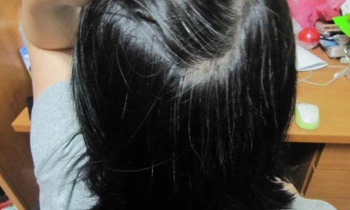  Natural Pack To Get Rid Of White Hair! Natural Pack, White Hair, Black Hair, Lat-TeluguStop.com