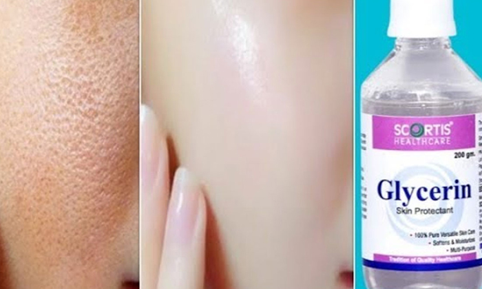  How To Make Dark Spots Removal Cream At Home! Dark Spots Removal Cream, Dark Spo-TeluguStop.com