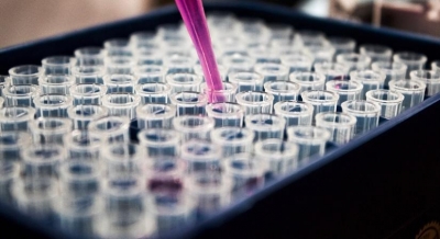  Scientists Develop New Combo Treatment For Head And Neck Cancer-TeluguStop.com