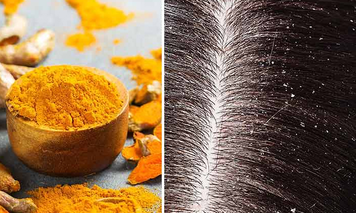  Turmeric Powder Prevents From White Hair! Turmeric Powder, White Hair, Black Hai-TeluguStop.com