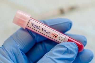  Us Scientists Develop Nipah Virus Vax That Can Save Lives In Just 3 Days-TeluguStop.com