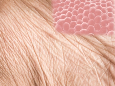  Ageing In Human Skin Cells Reversed By 30 Years-TeluguStop.com