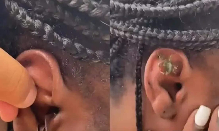  Crab In The Woman Ear Viral Video Details, Women, Viral Latest, News Viral, Soc-TeluguStop.com