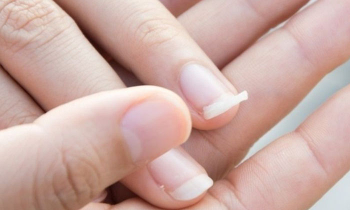  Why No Pain To Cutting Nails Nails, Cutting , No Pain , Keratin ,non-living Pr-TeluguStop.com