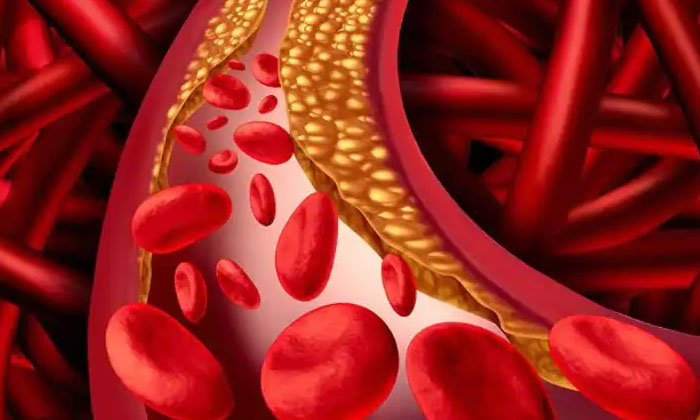 Telugu Bad Cholesterol, Tips, Healthy Heart, Heart, Heart Problems, Latest-Telugu Health Tips