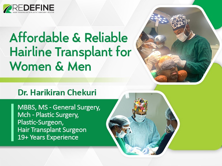  Affordable & Reliable Hairline Transplant For Women & Men-TeluguStop.com