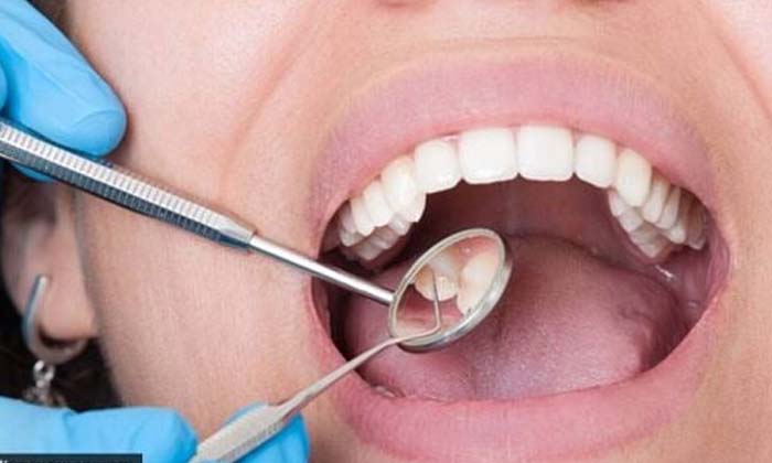  People Who Are Attracted To Turkey Teeth Doctors Say Danger , Torkey Theth, Vira-TeluguStop.com