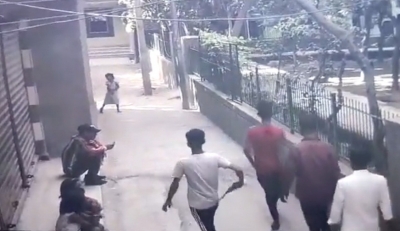 Delhi: Man Survives After Being Shot On Face, 4 Held Delhi: Man Survives After Being Shot On Face, 4 Held-TeluguStop.com