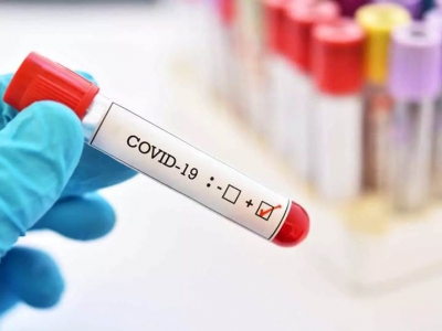  Delhi's Covid Tally Rises To 601, No New Death-TeluguStop.com