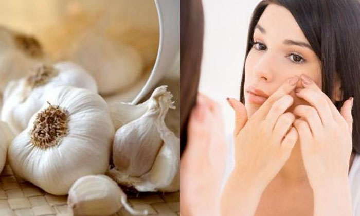  Do This With Garlic For Clear And Glowing Skin! Garlic, Clear Skin, Glowing Skin-TeluguStop.com