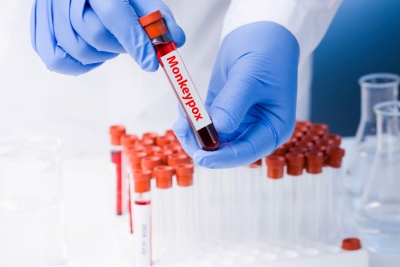  Monkeypox Vaccination Centre Opens In Paris-TeluguStop.com