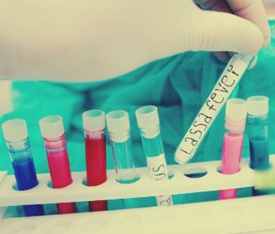  Scientists Discover Clue To Contain Lassa Virus Infection-TeluguStop.com