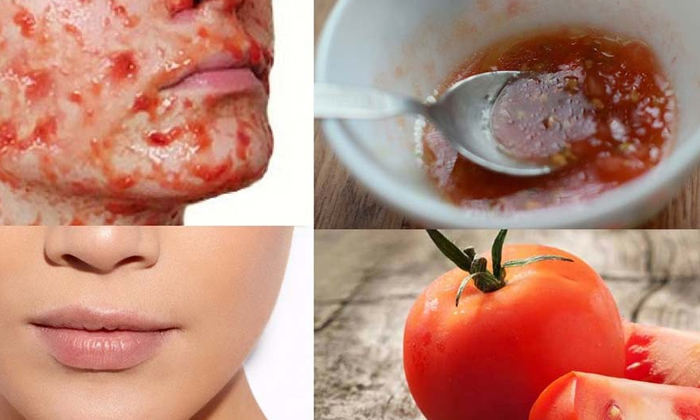 Telugu Tips, Benefits Tomato, Skin, Latest, Simple Remedy, Skin Care, Skin Care