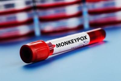 Uk 'must Take More Action On Monkeypox Or It Will Become Endemic' Uk 'must Take More Action On Monkeypox Or It Will Become Endemic'-TeluguStop.com