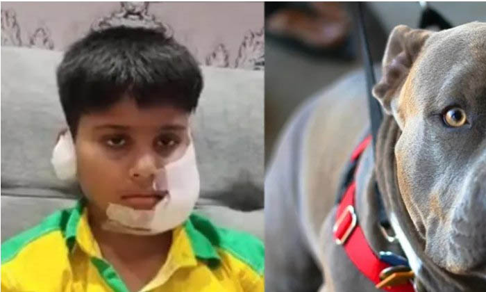  Viral: Atrocious, The Dog That Attacked A Ten-year-old Child 200 Stitches At On-TeluguStop.com