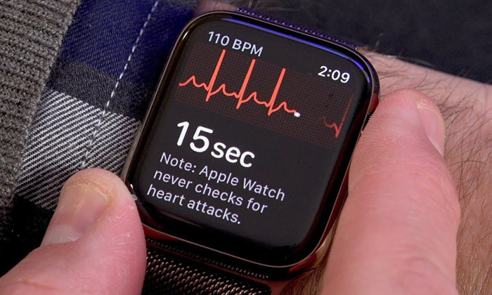  Apple Smart Watch Saves Life Ecg App,ecg App,apple Smart Watch,apple,electrocard-TeluguStop.com