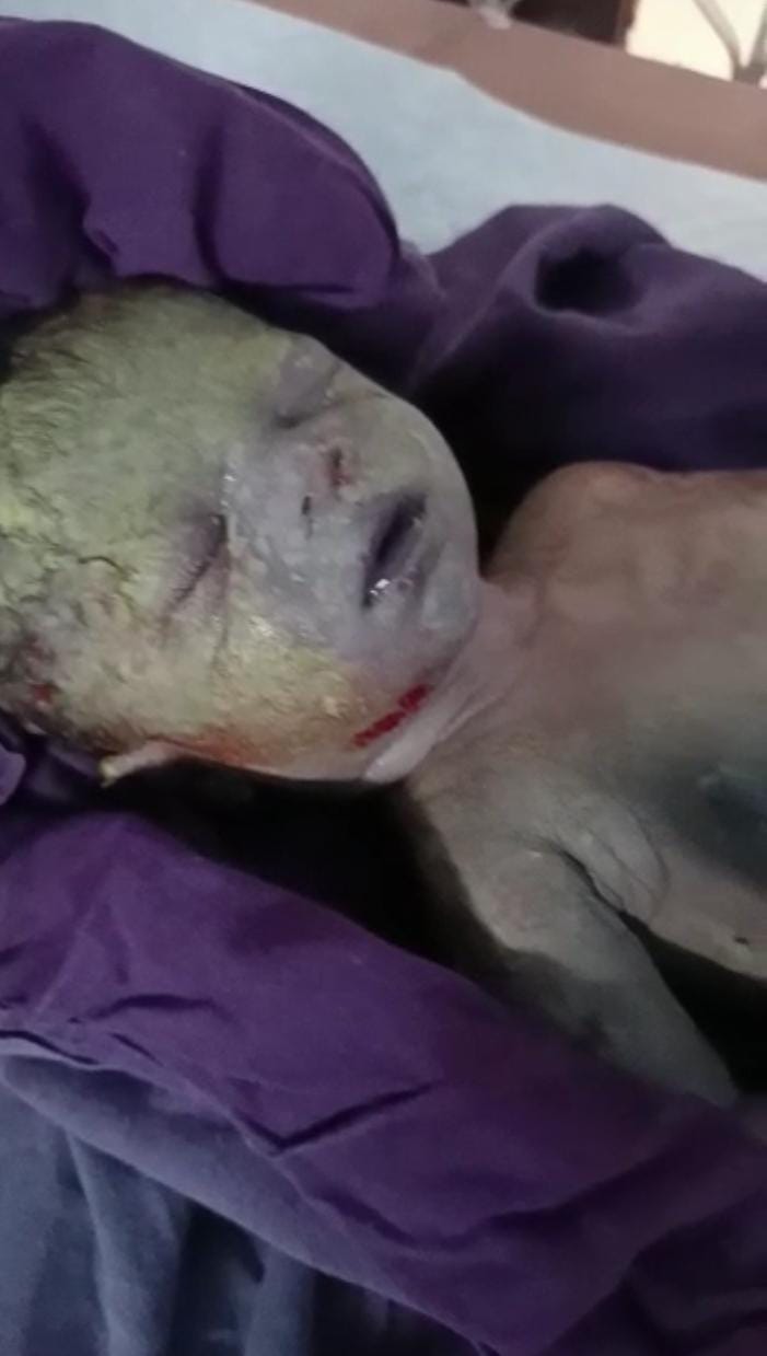  A Pregnant Baby Died Due To The Negligence Of A Private Doctor-TeluguStop.com